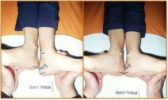 Allineamento Vertebrale @ Associazione Collaboratorio